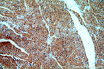 SMAD2 Antibody in Immunohistochemistry (Paraffin) (IHC (P))