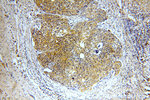 SMAD2 Antibody in Immunohistochemistry (Paraffin) (IHC (P))