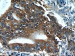 SMAD2 Antibody in Immunohistochemistry (Paraffin) (IHC (P))