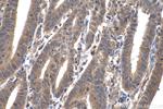 SMAD2 Antibody in Immunohistochemistry (Paraffin) (IHC (P))