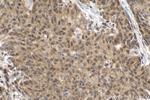 SMAD2 Antibody in Immunohistochemistry (Paraffin) (IHC (P))