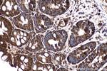 SMAD2 Antibody in Immunohistochemistry (Paraffin) (IHC (P))