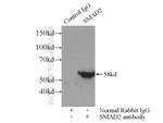 SMAD2 Antibody in Immunoprecipitation (IP)