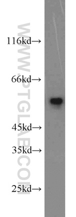 SMAD2 Antibody in Western Blot (WB)