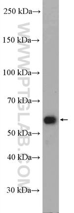 SMAD2 Antibody in Western Blot (WB)