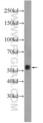 SMAD2 Antibody in Western Blot (WB)