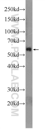 SMAD2 Antibody in Western Blot (WB)