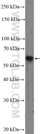 SMAD2 Antibody in Western Blot (WB)