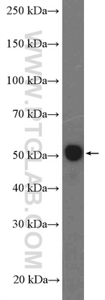 SMAD2 Antibody in Western Blot (WB)