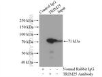 TRIM25 Antibody in Immunoprecipitation (IP)