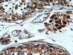 PTTG1IP Antibody in Immunohistochemistry (Paraffin) (IHC (P))