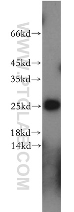 PTTG1IP Antibody in Western Blot (WB)