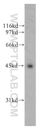 UBE2Q2 Antibody in Western Blot (WB)