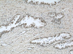 PTBP1 Antibody in Immunohistochemistry (Paraffin) (IHC (P))