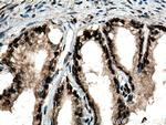 PTBP1 Antibody in Immunohistochemistry (Paraffin) (IHC (P))