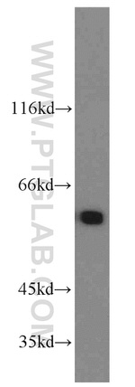 PTBP1 Antibody in Western Blot (WB)