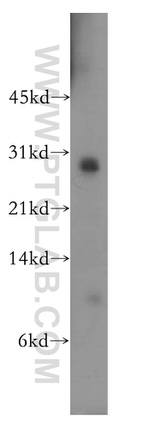 THAP1 Antibody in Western Blot (WB)