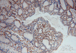 SAMHD1 Antibody in Immunohistochemistry (Paraffin) (IHC (P))