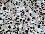 SAMHD1 Antibody in Immunohistochemistry (Paraffin) (IHC (P))