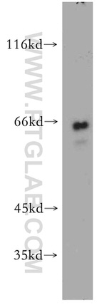 SAMHD1 Antibody in Western Blot (WB)