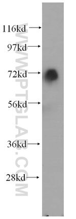 SAMHD1 Antibody in Western Blot (WB)