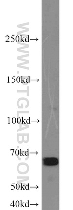 SAMHD1 Antibody in Western Blot (WB)