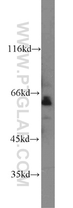 SAMHD1 Antibody in Western Blot (WB)