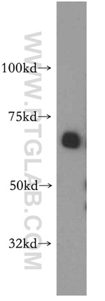 SAMHD1 Antibody in Western Blot (WB)