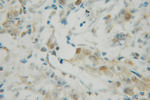 PDCD4 Antibody in Immunohistochemistry (Paraffin) (IHC (P))