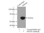 PDCD4 Antibody in Immunoprecipitation (IP)