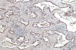 CRABP1 Antibody in Immunohistochemistry (Paraffin) (IHC (P))