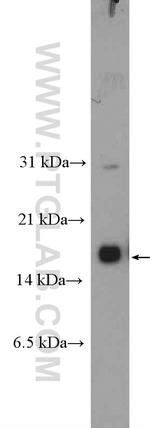 CRABP1 Antibody in Western Blot (WB)