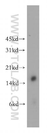 CRABP1 Antibody in Western Blot (WB)