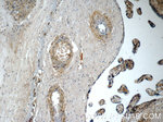 CDO1 Antibody in Immunohistochemistry (Paraffin) (IHC (P))