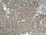 CDO1 Antibody in Immunohistochemistry (Paraffin) (IHC (P))