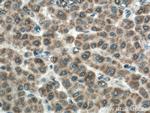 CDO1 Antibody in Immunohistochemistry (Paraffin) (IHC (P))