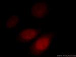 AKAP7 Antibody in Immunocytochemistry (ICC/IF)