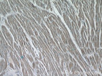 AKAP7 Antibody in Immunohistochemistry (Paraffin) (IHC (P))