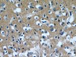 AKAP7 Antibody in Immunohistochemistry (Paraffin) (IHC (P))