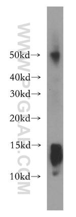 AKAP7 Antibody in Western Blot (WB)