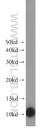 AKAP7 Antibody in Western Blot (WB)