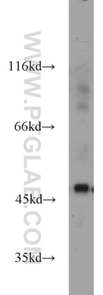 PANX1 Antibody in Western Blot (WB)