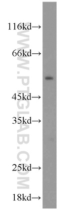 OLFM3 Antibody in Western Blot (WB)