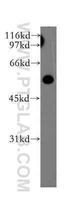 OLFM3 Antibody in Western Blot (WB)