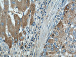 CTBS Antibody in Immunohistochemistry (Paraffin) (IHC (P))