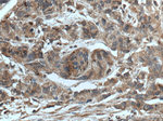 CTBS Antibody in Immunohistochemistry (Paraffin) (IHC (P))