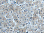 CTBS Antibody in Immunohistochemistry (Paraffin) (IHC (P))