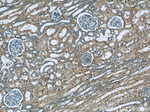 CTBS Antibody in Immunohistochemistry (Paraffin) (IHC (P))