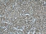 CTBS Antibody in Immunohistochemistry (Paraffin) (IHC (P))