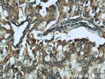 CTBS Antibody in Immunohistochemistry (Paraffin) (IHC (P))